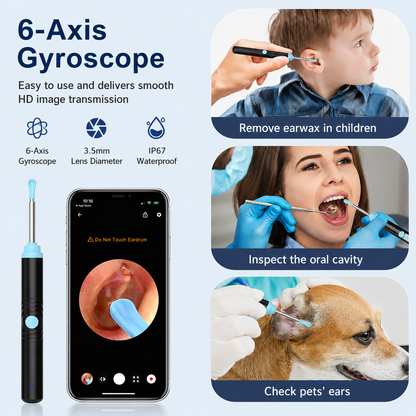 👂 Smart Visual Ear Cleaner with HD Camera 📷 | WiFi Ear Wax Removal Tool with LED Light & Waterproof Design